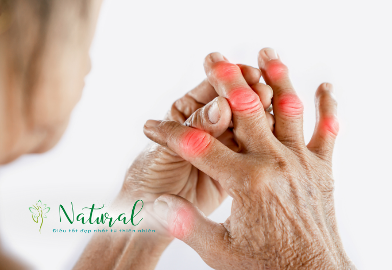 Gout nên kiêng ăn rau mồng tơi